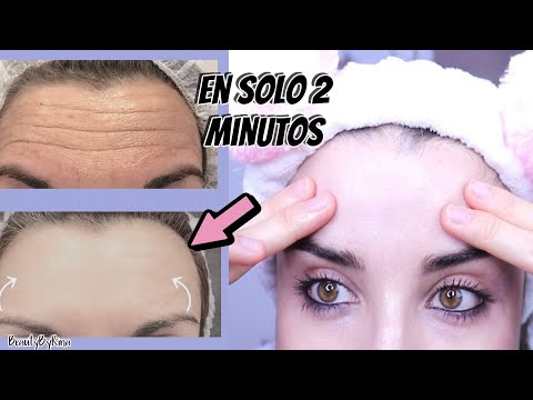 Video: Cómo reducir las arrugas en las mejillas: 11 pasos (con imágenes)