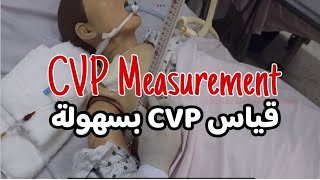 CVP procedure (EN-AR) - CVP طريقة قياس