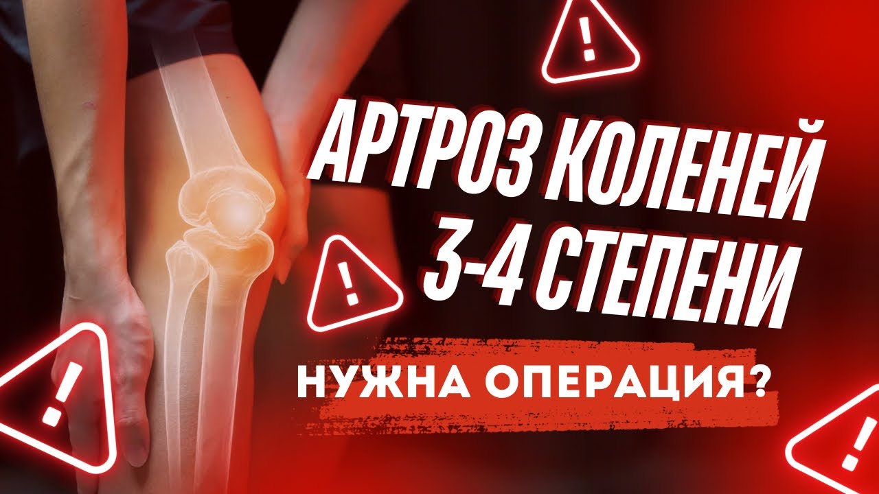 Артроз 3-4 степени. Мнение врача об операции. Эндопротезирование