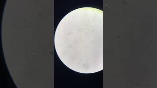 #microscope #parasite #what is this? #18 year old female #Trichomonas vaginalis