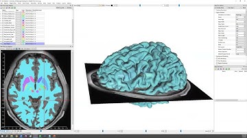 Drawing NIFTI file ROI using T1W image