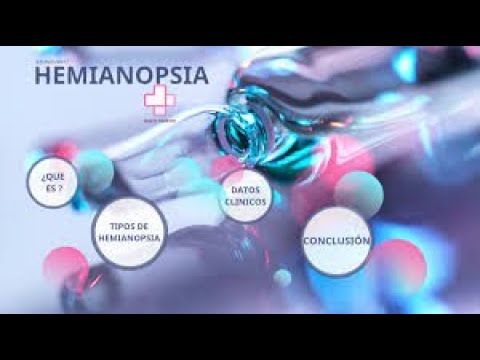 Video: Hemianopia: Definitie, Typen, Symptomen, Oorzaken En Behandeling