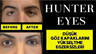 Düşük Gözkapağı Egzersizleri Göz Çekikleştirme Alt Ve Üst Göz Kapağı Yükseltme Hunter Eyes