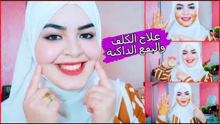 تبييض الوجه و إزالة الشوائب في دقائق و غير ب 3 دراهم علاج الكلف والبقع الداكنه وصفة رهيبة