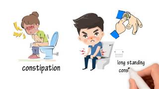 Why you should not strain with bowel movement or if you have constipation