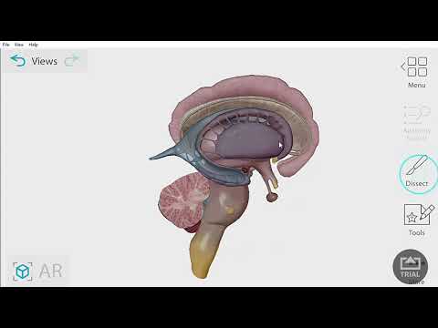 Corpus Callosum dan Ganglia Basalis