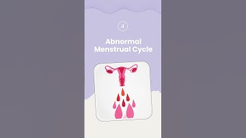 Unable to Conceive? Check These Factors...! | IVF | Infertility | Fertility Hospital In Hyderabad |