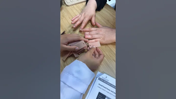 Custom Silicone Hand Prosthetics by Luxmed #luxmed #silicone #customfit #innovation