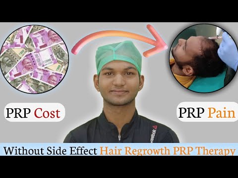 hair-loss-treatment।prp-therapy-cost-and-pain।side-effect।-sonu-kumar-mishra।