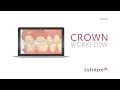 3shape trios  crown workflow