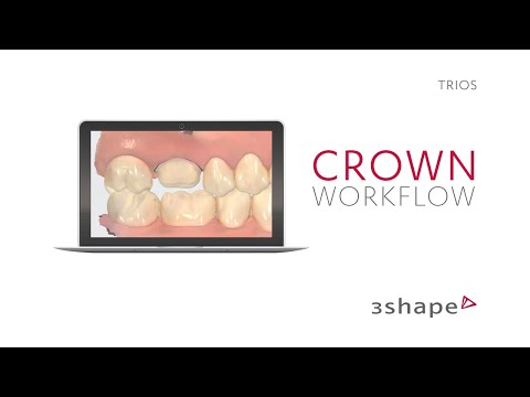 3Shape TRIOS - Crown Workflow