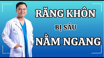 Răng khôn bị sâu nằm ngang |Dr Cường Official