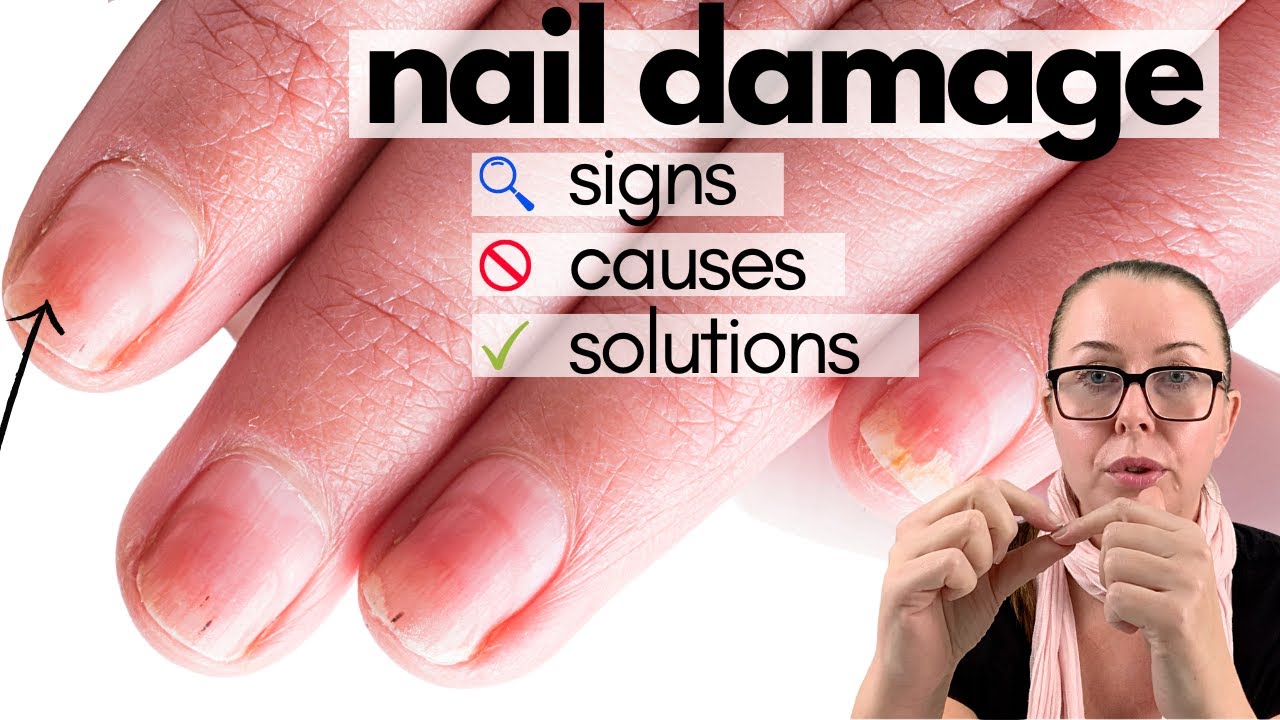 The One Surprising Thing That REALLY Wrecks Your Nails | by Erin Margrethe  | Medium