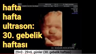 30 gebelik haftasinda anne karnindaki bebek aciklamali ultrason goruntuleri bebegin kilosu youtube