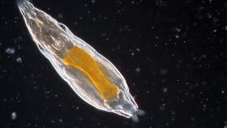 Bdelloid Rotifers: so common yet so weird!