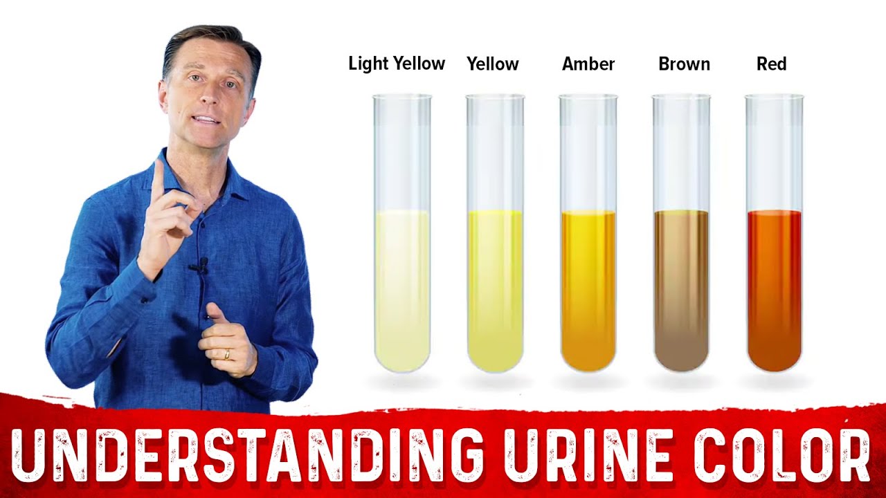 What Color Is Urine When Burning Fat