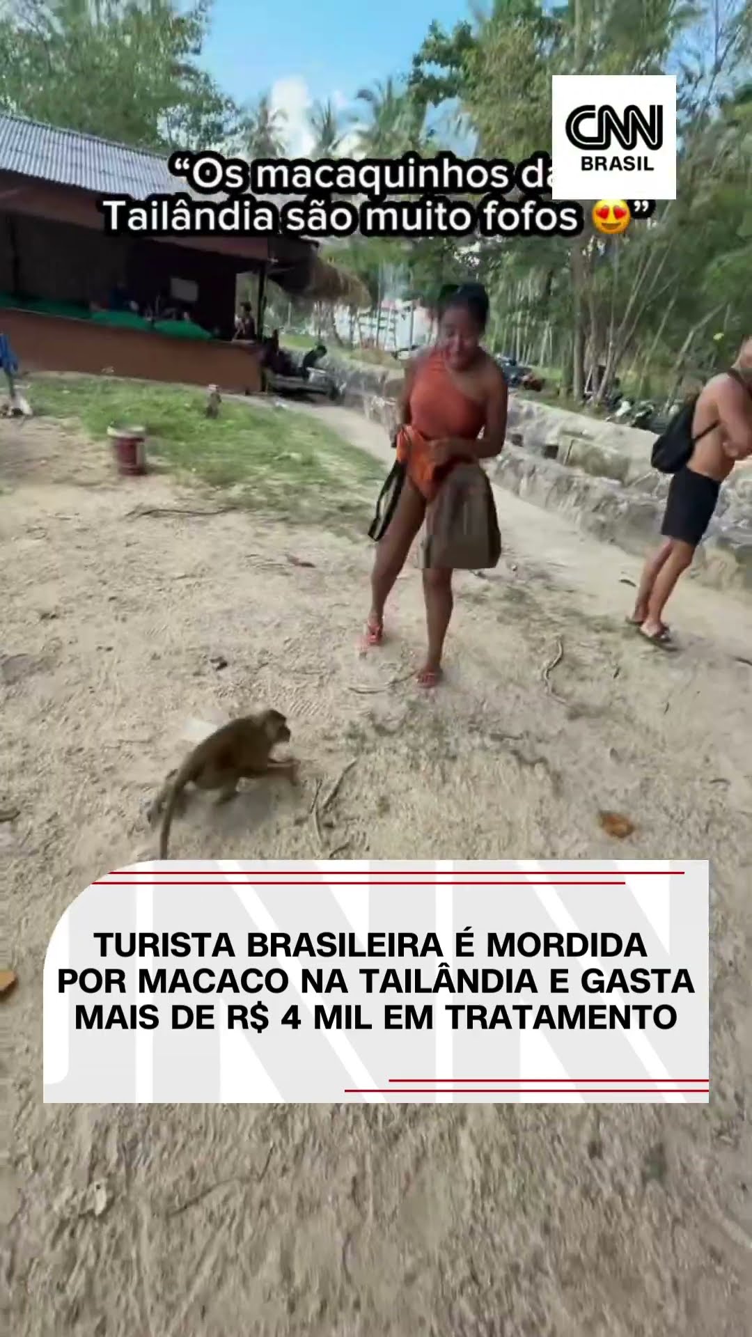 Turista brasileira é mordida por macaco na Tailândia e gasta mais de R$ 4 mil em tratamento #shorts