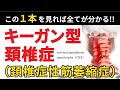 頚椎症性筋萎縮症（キーガン型）完全解説