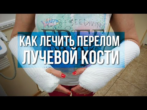 Как лечить перелом лучевой кости?