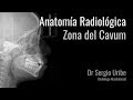 Radiologia   Anatomia   Cavum