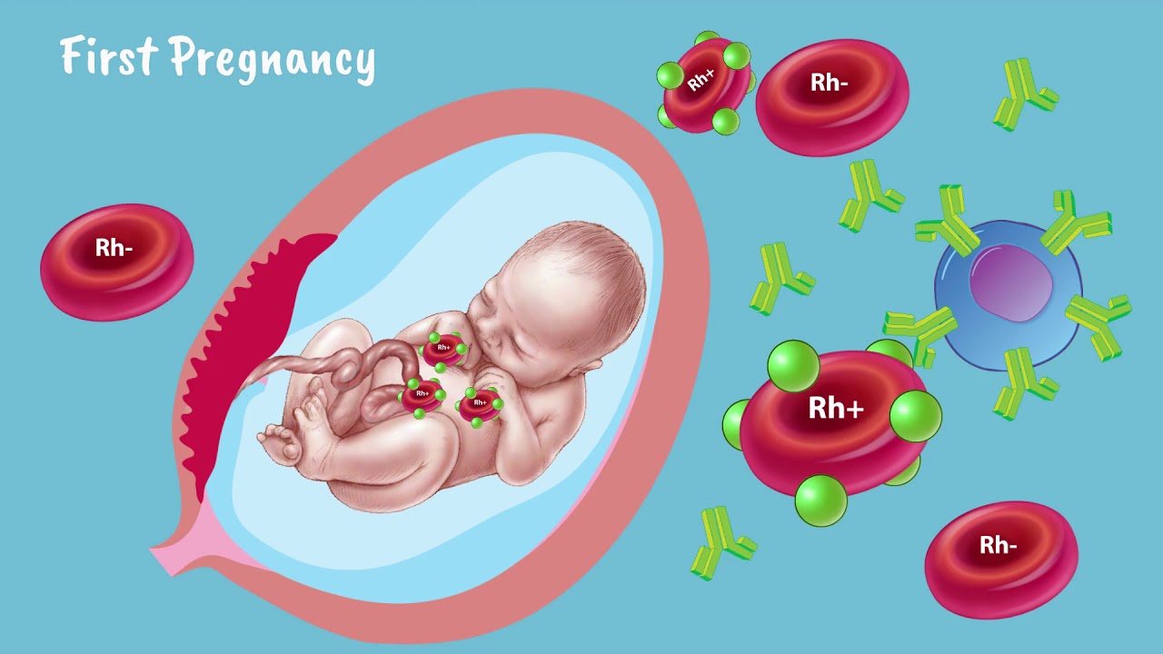 educational topic 19 alloimmunization