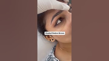 Healed Ombre Brows Transformation done by our experts at Dermalyn Aesthetics | Dermalyn Aesthetics |