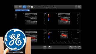 Venue Ultrasound Tutorial: Image Management | GE Healthcare screenshot 5