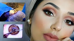 LIVE Laser Eye Surgery at London Vision Clinic | Q&A | My Experience