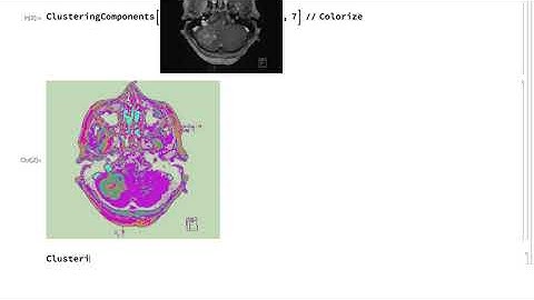 Introduction to Image Processing: Segmentation