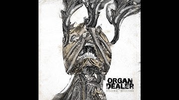 Organ Dealer - KPC-OXA48 (Organ Dealer - Visceral Infection)