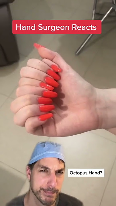 Too many fingers! #Polydactyly #Hand #Surgeon #Dr #Finger #Health #Medical