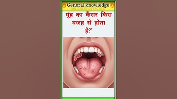 Gk Video || Interesting Gk || Gk In Hindi || General Knowledge || Gk ke sawal || ips || ips || upsc