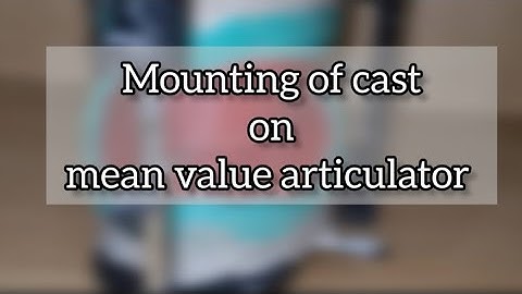 Mounting of cast in the articulator 🦷🩺👩‍⚕️