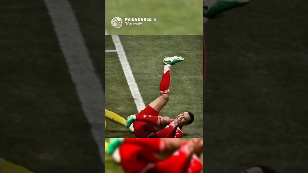Musiala 😭😭💔 #football #soccer #bayernmunich #musiala #psg #injury #viral #edit #foryou #shorts