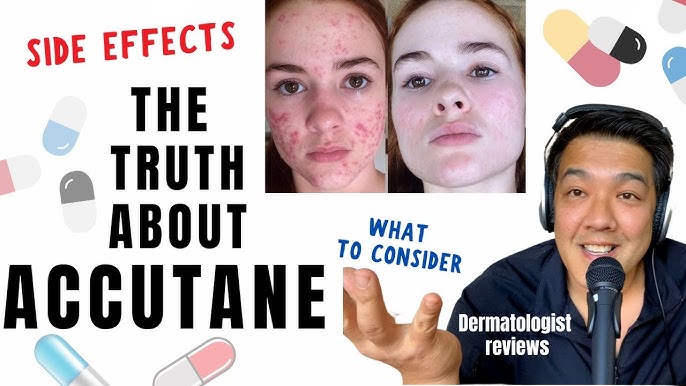 Average price for accutane