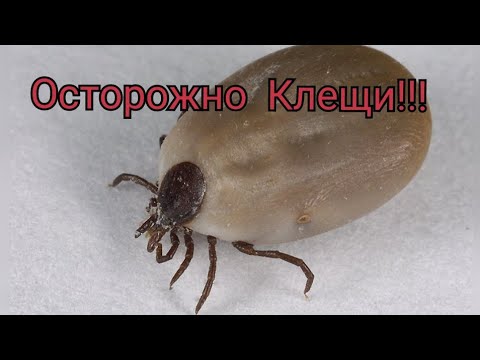 Что будет, если УКУСИТ КЛЕЩ? Как КУСАЕТ КЛЕЩ? 5 Способов Вытащить  #shorts #клещи #энцефалит