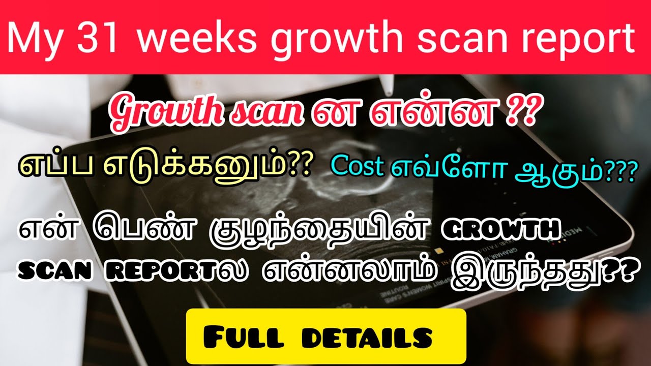 Fetal Growth Scan In Tamil 3rd Trimester Scan In Tamil My Growth fetal-growth-scan-in-tamil-3rd-trimester-scan-in-tamil-my-growth