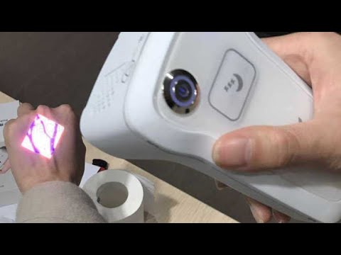 جهاز الكشف عن الاوردة