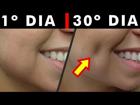 Vídeo: Algumas dicas sobre como sorrir lindamente