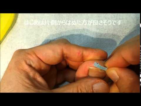 巻き爪用クリップを解説 ドクターショールー大木皮膚科 病院 東京 巻き爪用クリップを解説 ドクターショールー大木皮膚科 病院 東京