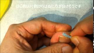 巻き爪用クリップを解説！ドクターショールー大木皮膚科/病院・東京