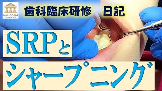 歯科臨床研修日記　SRPとシャープニングについて