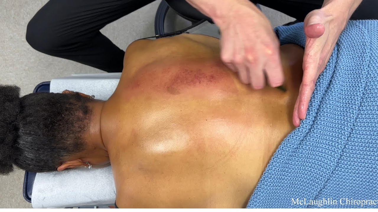 Unintentional ASMR *FIRST NECK CRACK* 🥲 Her Reaction 🥹 Soothing Treatment Helps Fix Posture