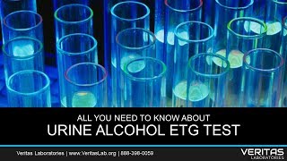EtG Urine Alcohol Test All You Need to Know FAQ