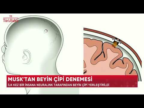 MUSK'TAN BEYİN ÇİPİ