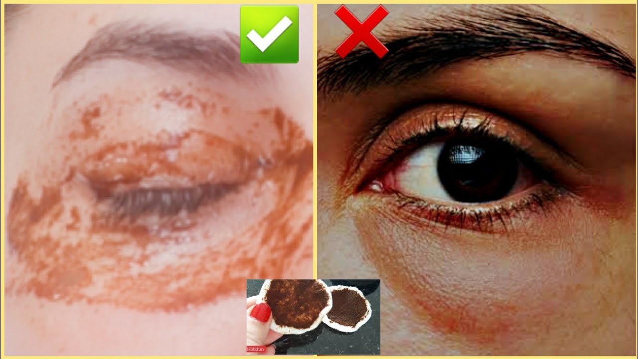 1 Haftada Goz Alti Kirisiklik Ve Morlugu Bitsin Puruzsuz Goz Alti Icin Keten Tohumu Maskesi Youtube 1 Haftada Goz Alti Kirisiklik Ve Morlugu Bitsin Puruzsuz Goz Alti Icin Keten Tohumu Maskesi Youtube