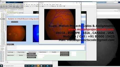 Analysis on retinal diseases using machine learning algorithms matlab project : +91 83000 15425