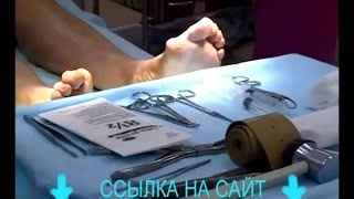 подагра симптомы диета. выросла косточка на ноге подагра симптомы диета. выросла косточка на ноге