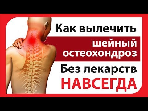 Шейный Остеохондроз. Как Лечить