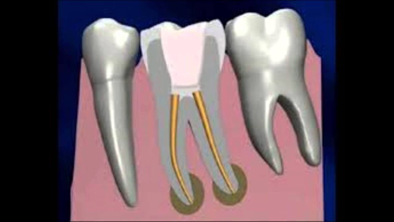 Relación de otras especialidades con la endodoncia. - YouTube